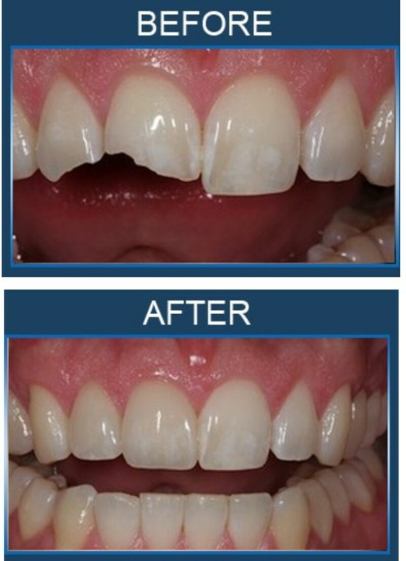teeth123 teeth123